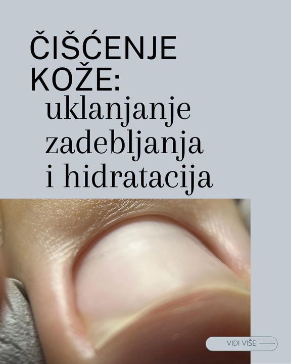 Čišćenje kože: uklanjanje zadebljanja i hidratacija